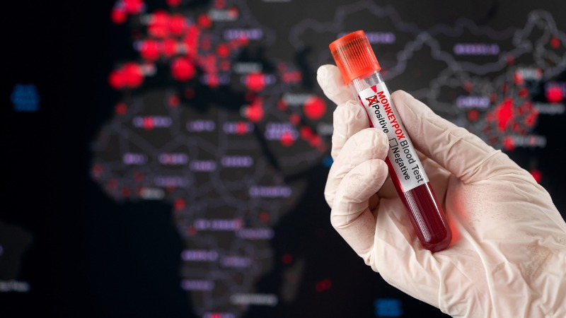 variole-singe-mpox-diagnostic